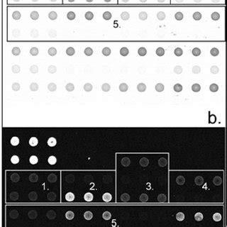 Colorimetric A And Fluorescent B Array Genotyping Of