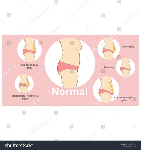 Bloated Stomach Vs Pregnant Stomach