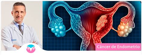 Signs And Symptoms Of Endometrial Cancer Endometrial Cancer Treatment