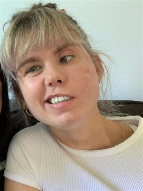 Brisbane Nurse Tori Dent Dreams Of Being Able To Smile After Rare Brain