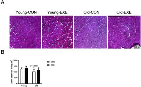 Difference In Fiber Cross Sectional Area Csa Of Skeletal Muscles Of