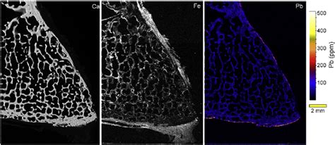 Synchrotron Mxrf Compositional Maps Of Vertebra Section From Ferrante Download Scientific