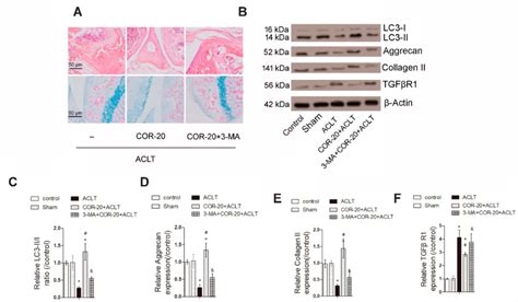 Autophagy Inhibitor Ma Reversed The Effects Of Cor On Aclt Induced