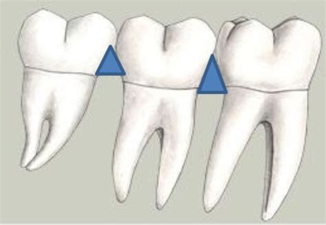 Oral Anatomy Lecture Anatomical And Physiologic Considerations Of