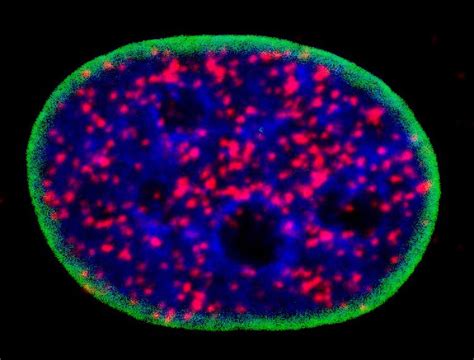 Avance Contra El Cáncer Se Descubre Un Vínculo Inesperado Entre Las