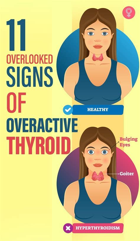 Symptoms Of Overactive Thyroid Low Estrogen Symptoms Thyroid Gland