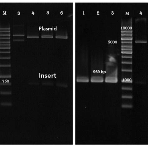 Agarose Gel Electrophoresis Showing Colony Pcr And Restriction Enzyme Download Scientific