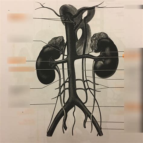 Inferior Vena Cava And Its Tributaries Diagram Quizlet