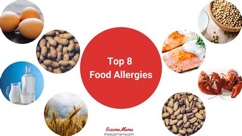 What are Food Allergies? Symptoms and Causes - Eczema Mama