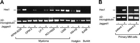 Jagged1 Induced Notch Target Gene Activation In Mm Cells A Download Scientific Diagram