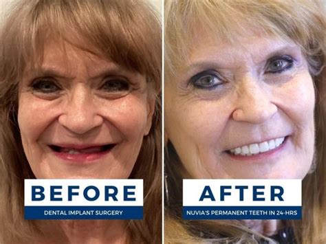 Nuvia Dental Implant Center Updated January Photos