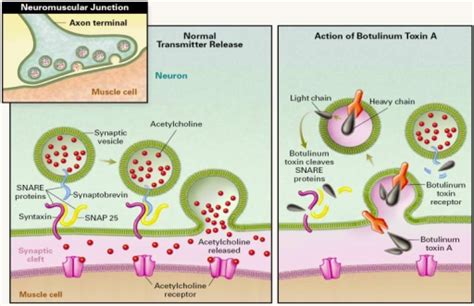 Mechanism Of Action Of Botulinum Neurotoxin Left Side Open I