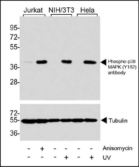 Anti Phospho P Mapk Y Antibody Boster