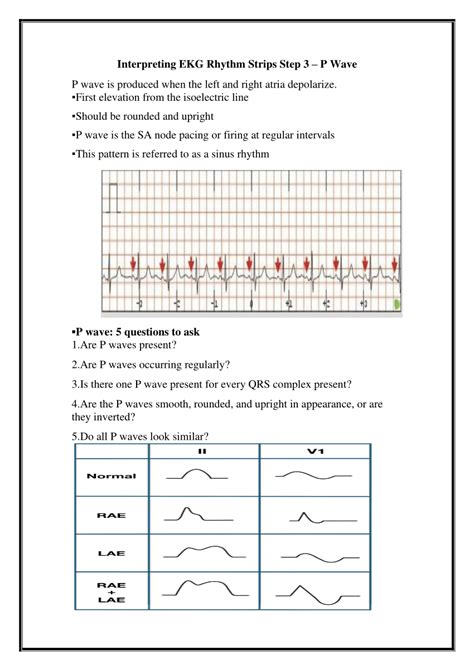 Pdf Interpreting Ekg Rhythm Strips Step P Wave