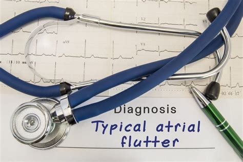 Understanding The Causes And Symptoms Of Atrial Flutter Facty Health