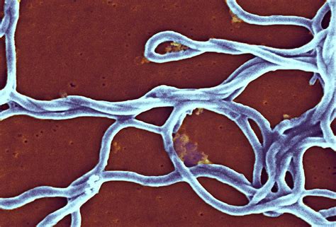 Borrelia Burgdorferi Bacteria 1 By Science Photo Library