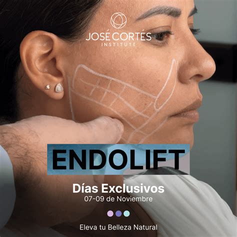 Rinoplastia ultrasónica en México José Cortés Institute