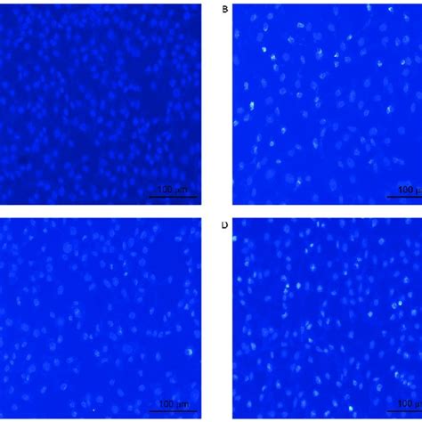 Hoechst 33258 Staining Of U 2OS Cells Apoptotic Nuclei Exhibited