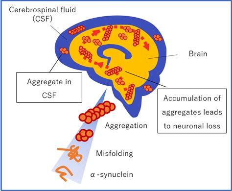 Novel And Rapid Device Opens New Doors For Parkinsons Disease