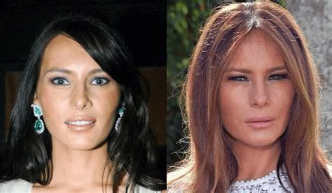 Melania Trump Claims She Hasn T Had Plastic Surgery And Is Against