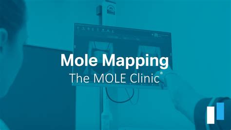 The Mole Clinic® Mole Mapping Youtube