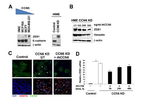 Ccn6 Regulates Zeb1 Expression And The Epithelial Mesenchymal