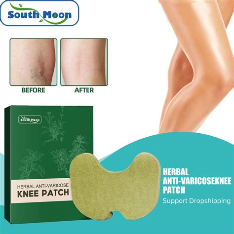 South Moon 12pcs Varicose Veins Phlebitis Patch Herbal Removal Blood