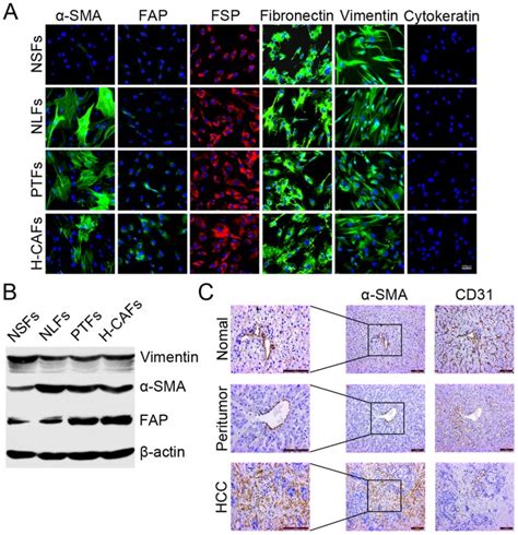 A The Expression Of α Sma Fap Fsp Vimentin Fibronectin And