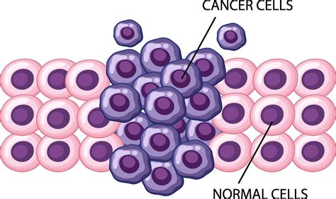 Process Of Cancer Cell Development 7002517 Vector Art At Vecteezy