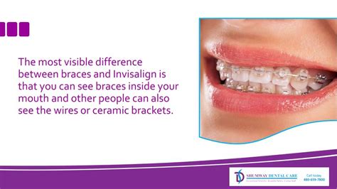 Ppt The Visible Difference Between Invisalign And Braces Powerpoint