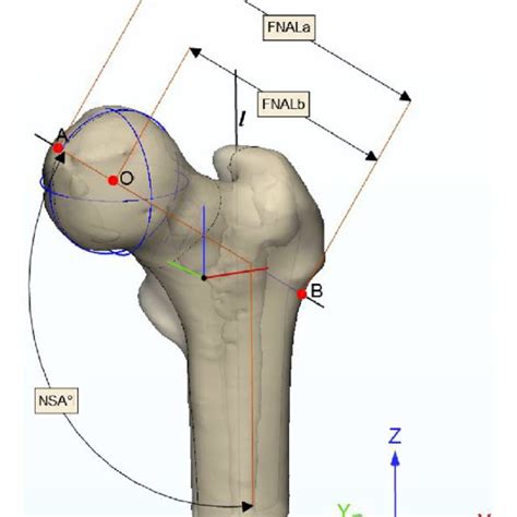 Measurement Of Proximal Femur Geometry Pfg Neck Shaft Angle Nsa Is Download Scientific