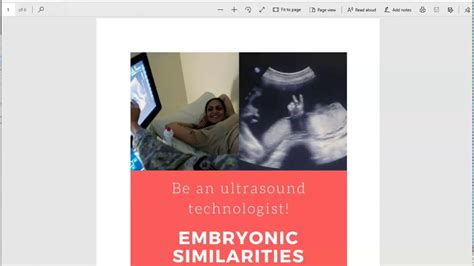 Embryonic Similarities Lesson Plan And Powerpoint Be An Ultrasound