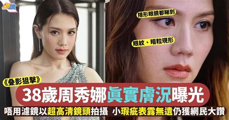 38歲周秀娜超高清鏡頭拍劇膚況曝光 有眼紋暗粒仍獲網民大讚夠真實 最新娛聞 東方新地