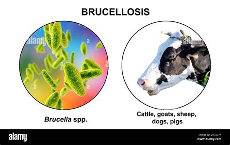 Brucella Bacteria The Causative Agent Of Brucellosis Computer Illustration Brucella Is A Gram