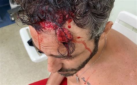 Ator Thiago Rodrigues é espancado por bandidos no Rio veja foto