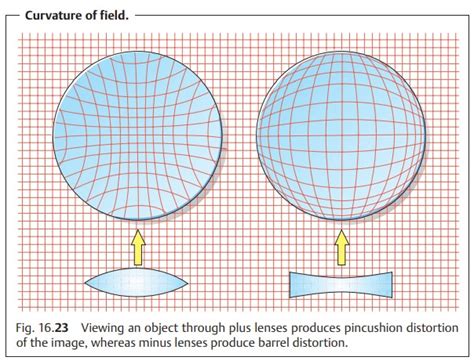 Aberrations Of Lenses And Eyeglasses Correction Of Refractive Errors