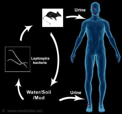 leptospirosis symptoms in humans - Anna Mathis