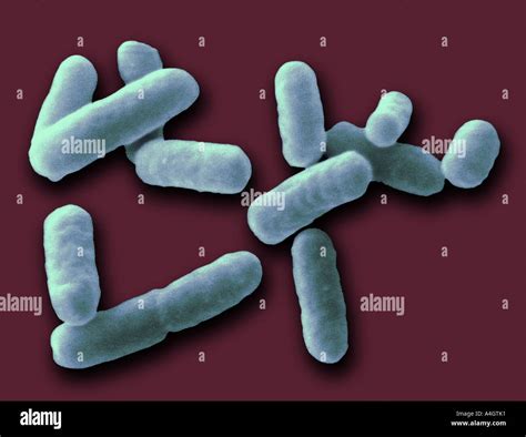 Bacteria Shigella S Fotograf As E Im Genes De Alta Resoluci N Alamy