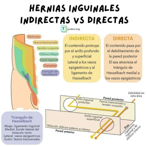 Hernias Inguinales Yudoc Org Udocz