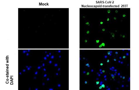 Sars Cov 2 Nucleocapsid Strain Wuhan Hu 1 Polyclonal Antibody