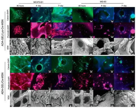 Gels Free Full Text Mesoporous Materials Make Hydrogels More