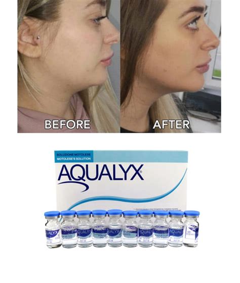 Aqualyx Fat Dissolving Injection With Best Price China Double Chin Reduction And Face Body