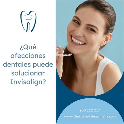 Que Afecciones Dentales Se Pueden Corregir Con Invisalign Cl Nica