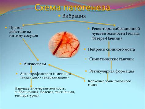 Вибрационная болезнь - презентация онлайн