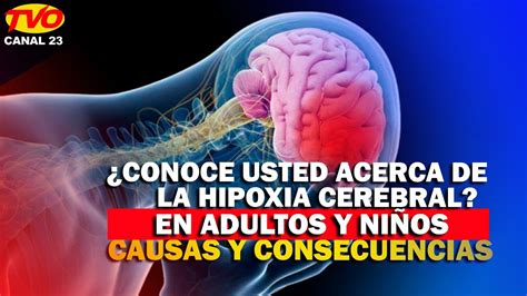 Conoce usted acerca de la hipoxia cerebral en adultos y niños Causas