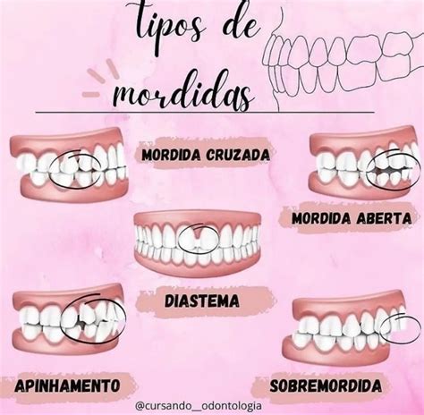 Pin De Nathi Leite Em Odontologia Odontologia Ortodontia Assistente