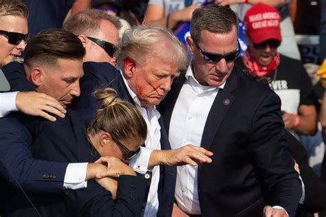 Trumps Ear Looks Like It Couldnt Have Gone Through Less After Rally