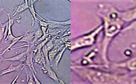 Células Mesenquimales Un Sabueso Para La Epoc