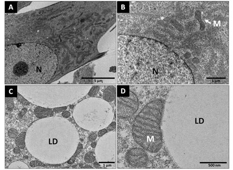 Differentiation And Imaging Of Brown Adipocytes From The Stromal