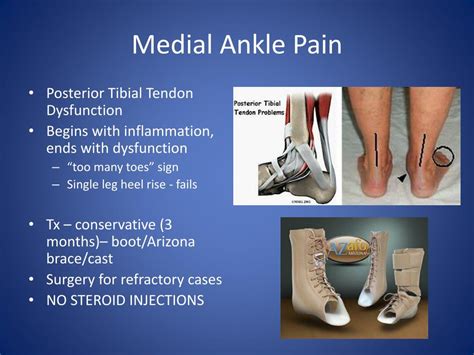 PPT - Chronic Ankle Pain PowerPoint Presentation, free download - ID ...